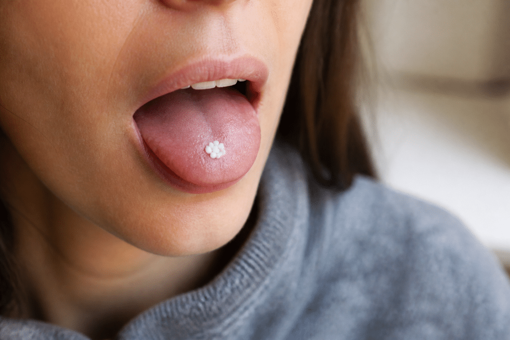 Globules homéopathiques fondant sous la langue d'une personne